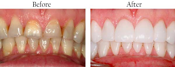 dental images 28658