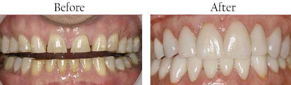 Maiden dental images